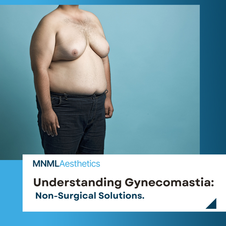 Understanding Gynecomastia and Non-Surgical Solutions