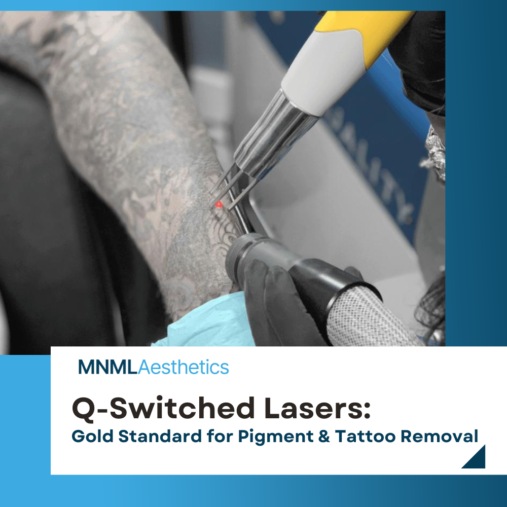 Q-Switched Lasers: The Gold Standard for Pigment and Tattoo Removal ...